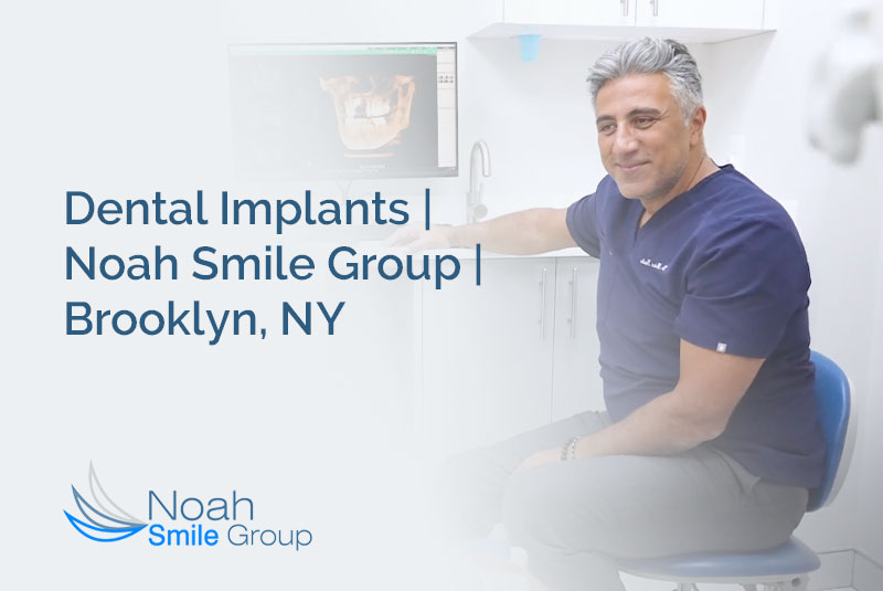dr nawlo dr implants thumbnail mt